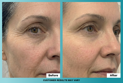 Anti-Aging Face Cream (Plus Free Gifts)