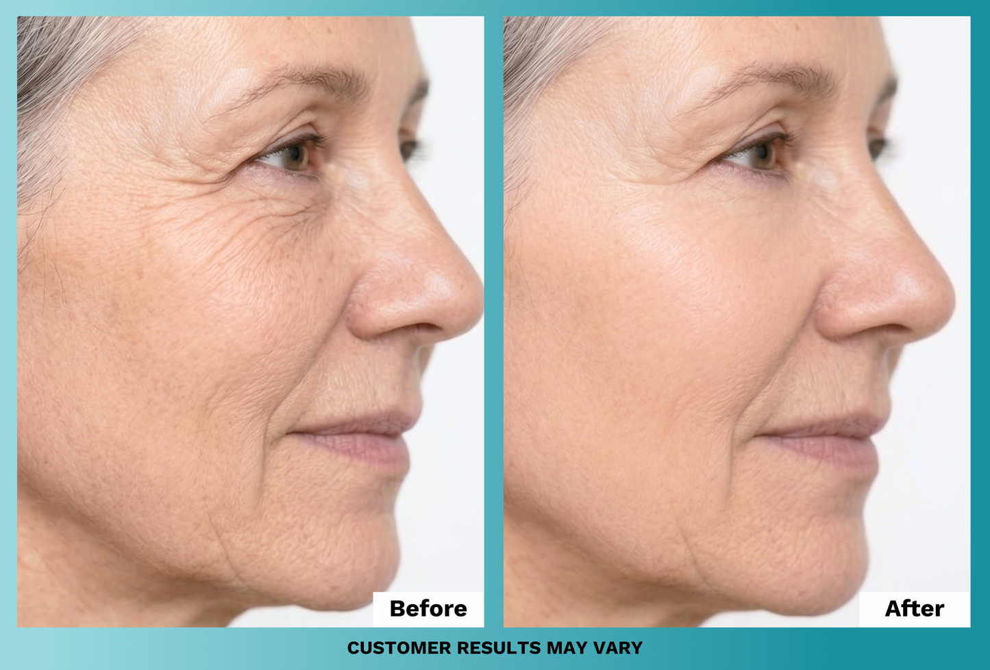 Anti-Aging Face Cream (Plus Free Gifts)