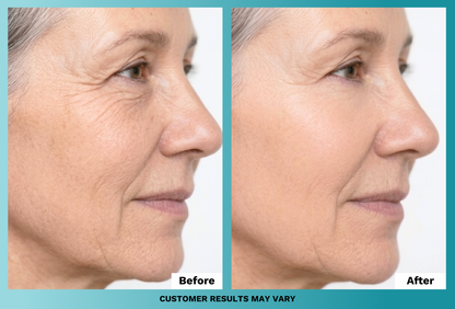 Anti-Aging Face Cream (Plus Free Gifts)
