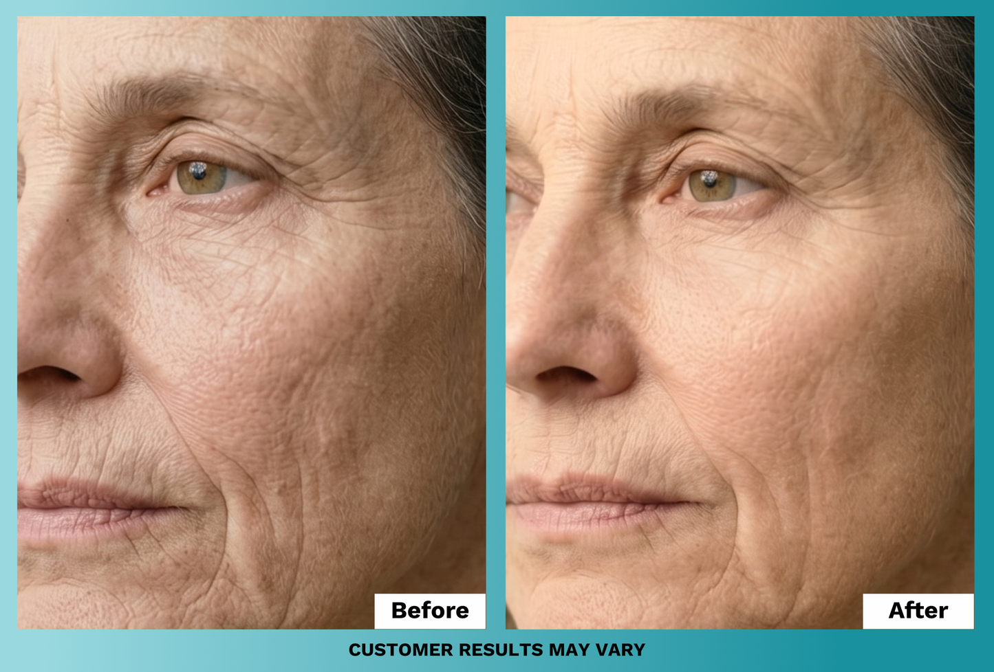Anti-Aging Face Cream (Plus Free Gifts)